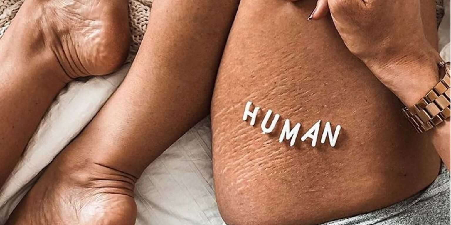 Here’s How You Can Become a Part of the Body Positivity Movement